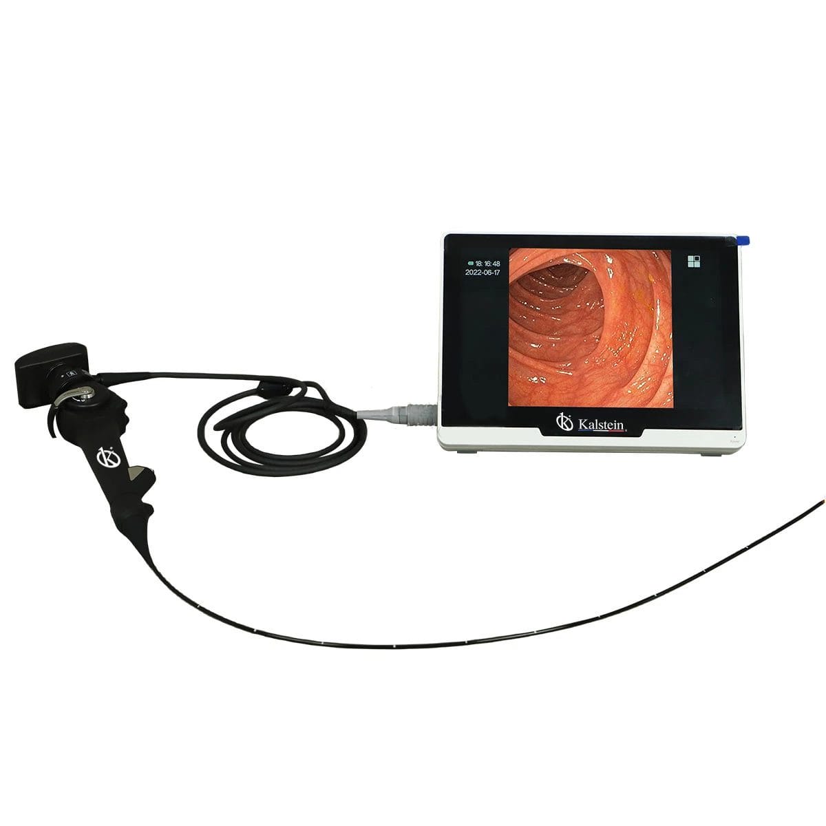 Interpreting Results and Measurements of the YR06155 Portable HD Veterinary Video Endoscope