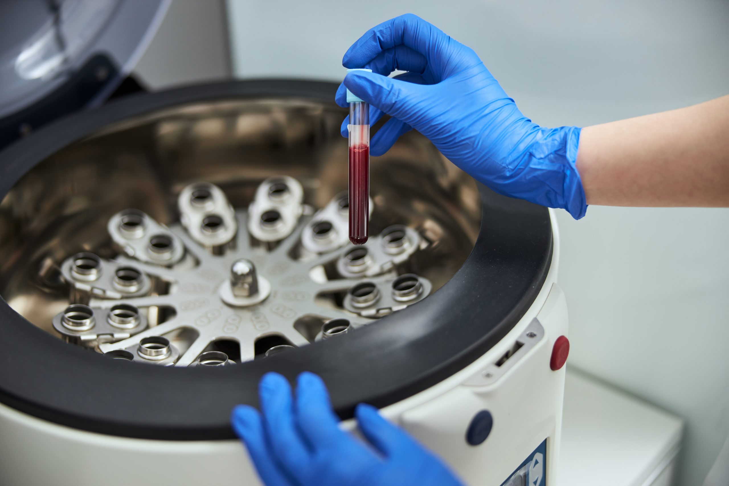 Centrifuge: How to separate samples?