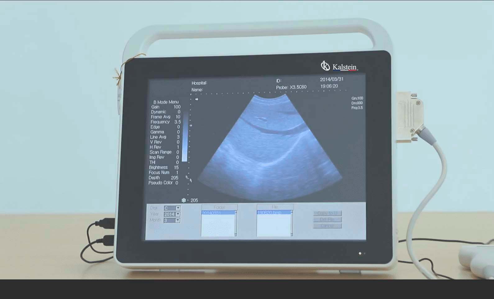 Unveiling the Power: Kalstein Ultrasound Scanners
