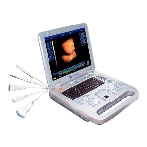 What is an ultrasound scanner?