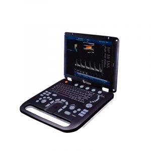 What does an ultrasound do?