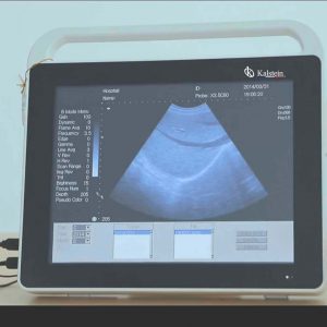 Medical ultrasound