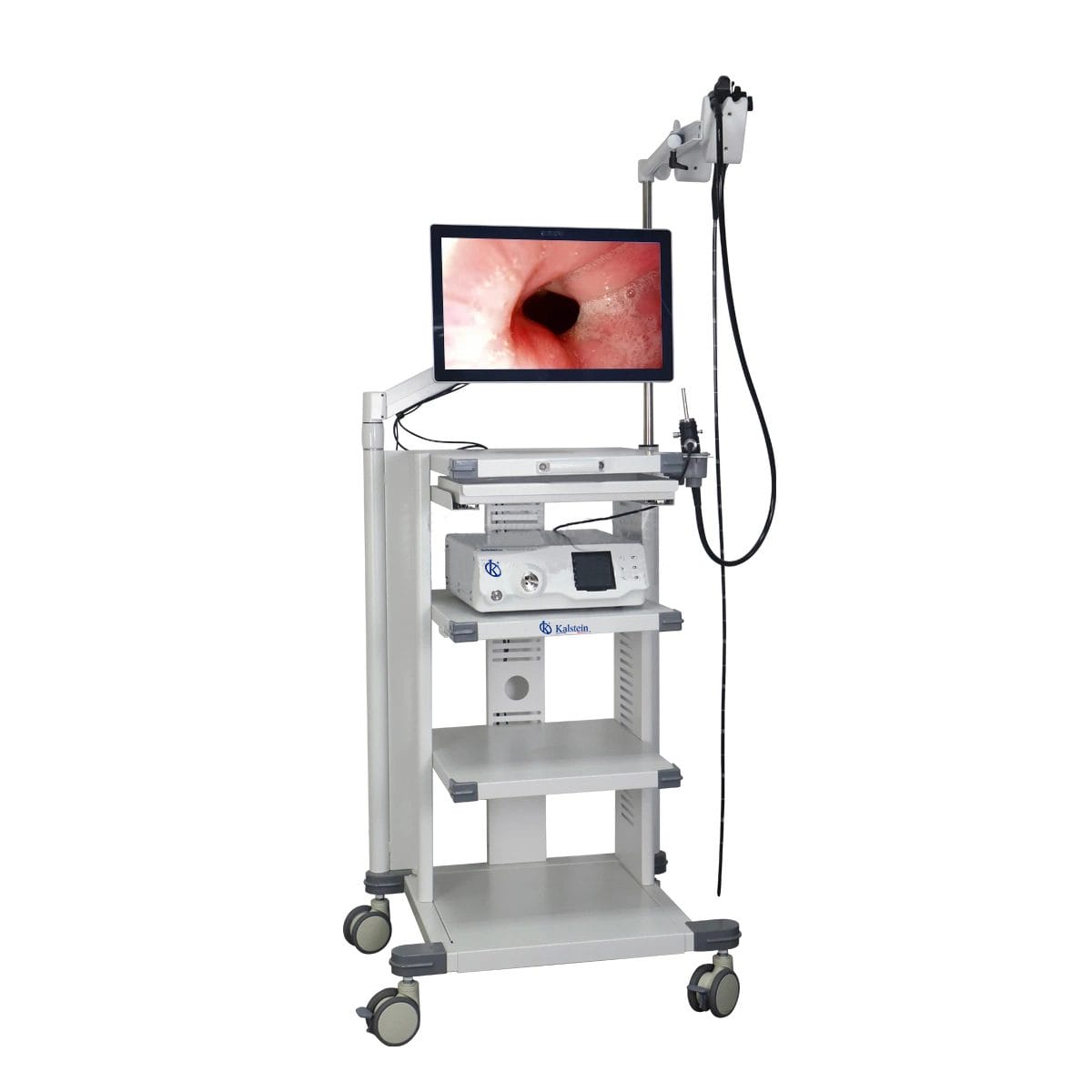 Veterinary Video Endoscope: High-Definition Internal Visualization for Diagnostics