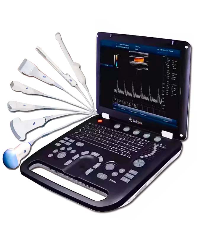Ultrasound Scanner: High-Definition Images for Precise Diagnoses